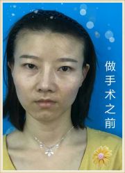-郑州米兰柏羽集美医疗美容医院