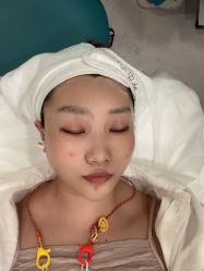 体验后-海涛医疗美容·面部抗衰·注射美鼻