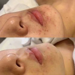 -Cream88颜皮肤管理中心