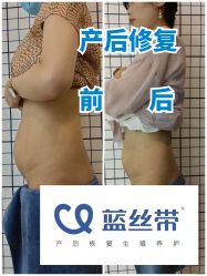 -蓝丝带产后恢复中心(都江堰店)