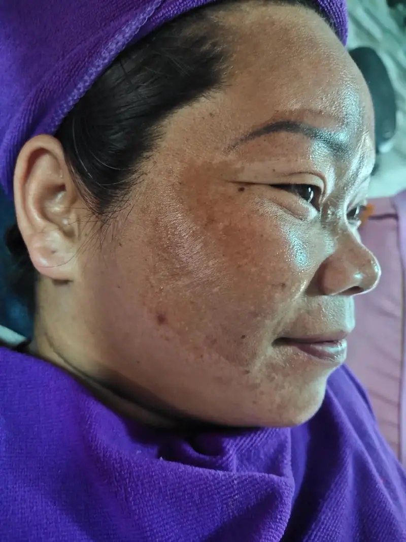 大黑脸调肤效果对比图