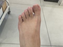 -世龙世家·灰指甲·甲沟炎·嵌甲矫正(双楠店)