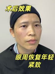 -广州健丽·去眼袋医疗美容机构