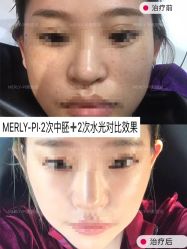 -MLP美丽派·问题肌疗愈中心