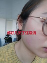 -八大处整形