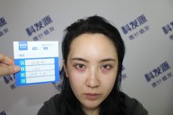 -大麦微针植发丨全国连锁