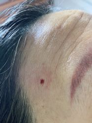 -痣清宫祛斑祛痣连锁店