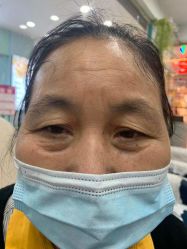 -美人痣全国连锁