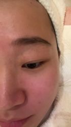 体验前-洛伊科技抗衰护肤中心