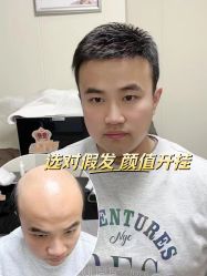 -唐风采假发补发定制