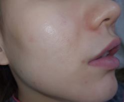 -E·plus 美肤中心