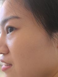 -长沙雅美医疗美容医院
