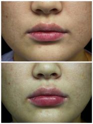 -天津健丽·去眼袋医疗美容机构