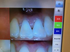 -团圆口腔·种植中心(锦江院区)