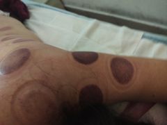 -益友堂盲人推拿正骨穴位按摩工作室