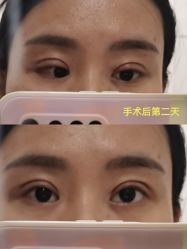 体验后-美莱医学美容医院