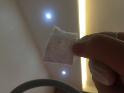 -成都苗方清颜专业祛痘