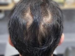 -LAQUEEN 时尚健康假发(万象城总店)