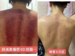 -丽减美瘦吧·减肥瘦身
