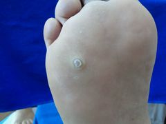 -世龙世家甲沟炎·灰指甲·嵌甲矫正·修脚(武侯区双楠店)