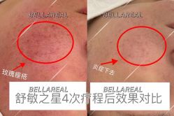 -BELLAREAL新美社