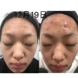 -黎蓓露·徒手骨雕蛋白抗衰·调肤管理