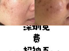 -布吉佳兆业广场