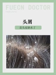 -Bollins波林丝•专研护发中心