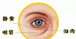 -广州健丽·去眼袋医疗美容机构