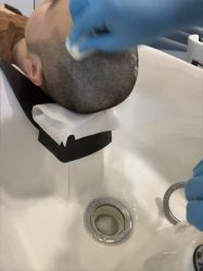 -大麦微针植发丨全国连锁