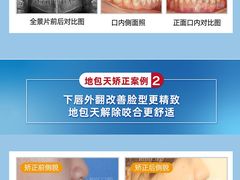 -柏乐口腔(南宁总院)