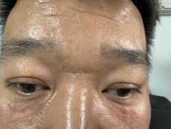 点击看大图 -北京美痣堂古方祛痣斑疣瘊