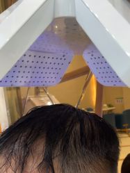 -碧莲盛·不剃发植发