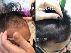 -凌氏生发养发馆