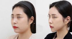 -CMS西美斯·美式医疗美容