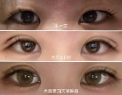 体验前-SKINIST丽铂医疗美容