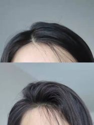 -UnHair Salon