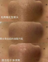 -慈蕊美容养生·专业经络调理