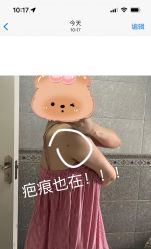 体验后-美莱医疗美容医院