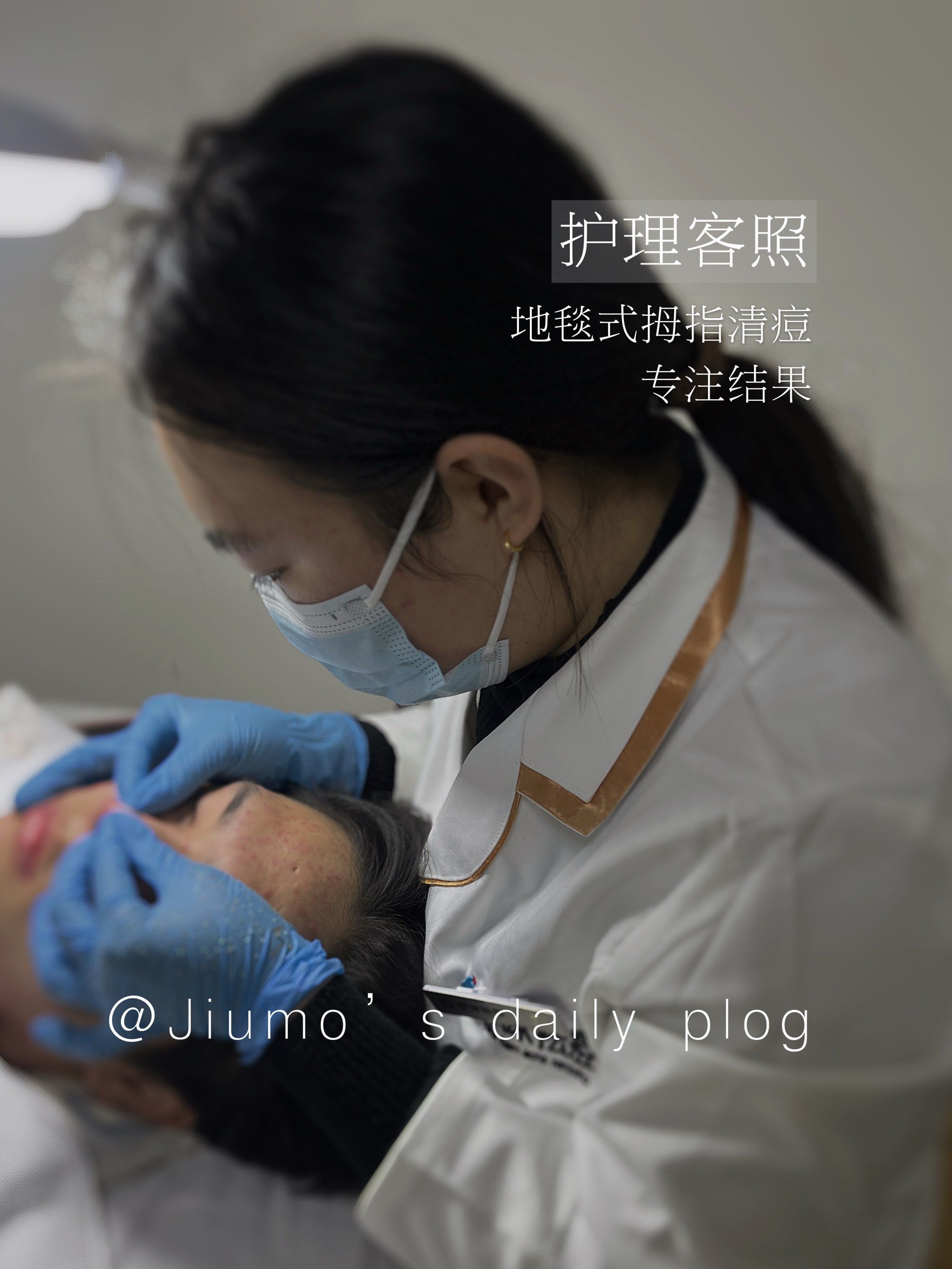 清痘清了三小时