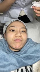 -苗老祖痘敏斑激素脸问题皮肤修复中心