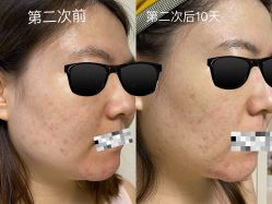 -和颜一美轻医美连锁