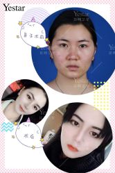 -Yestar艺星医疗美容医院