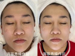 -安吉拉青春化管理中心