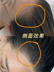 -MISS STAR·半永久纹眉·发际线·美瞳线