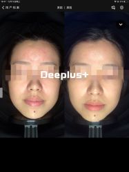 -Deeplus+韩国皮肤管理한국피부관리·C:Lab肌肤实验室