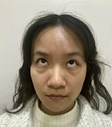 -广州健丽·去眼袋医疗美容机构