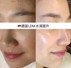 -KINI绮丽·美学肌SPA进口仪器专业店