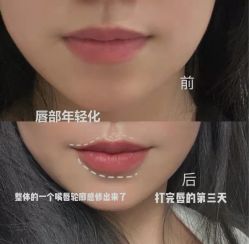 -上海漾颜医疗美容