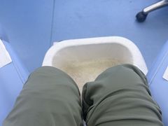 -Andrew指甲专科灰指甲·甲沟炎矫正·3D步态矫形鞋垫定制(浦三路店)
